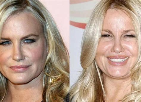 Jennifer Coolidge Was Slammed With Plastic Surgery。